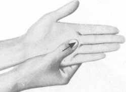 肥胖症按摩部位图解