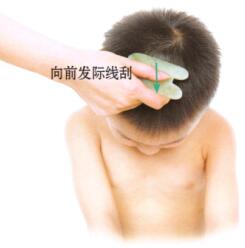 小儿惊风刮痧部位图解
