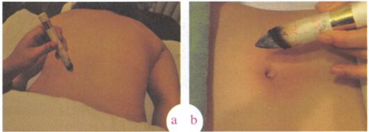 中风艾灸哪个部位图解