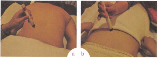 胃脘不适艾灸哪个部位图解