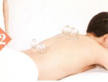 遗精拔罐部位图解