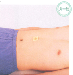 慢性胃炎艾灸哪个部位图解