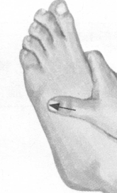 肩周炎按摩部位图解