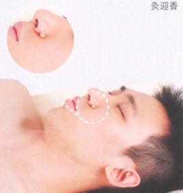 酒渣鼻艾灸哪个部位图解