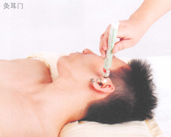 耳鸣艾灸哪个部位图解