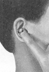 高脂血症按摩部位图解