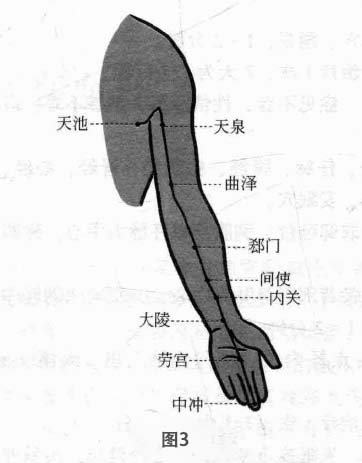 失眠病磁圆梅针疗法