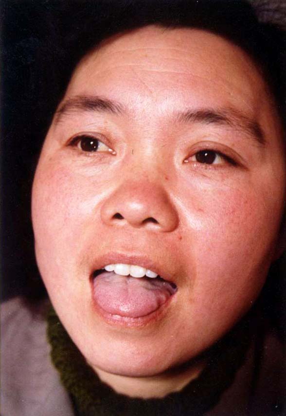 中医望神之有神