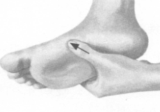 糖尿病按摩部位图解