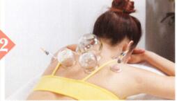 肩周炎拔罐部位图解