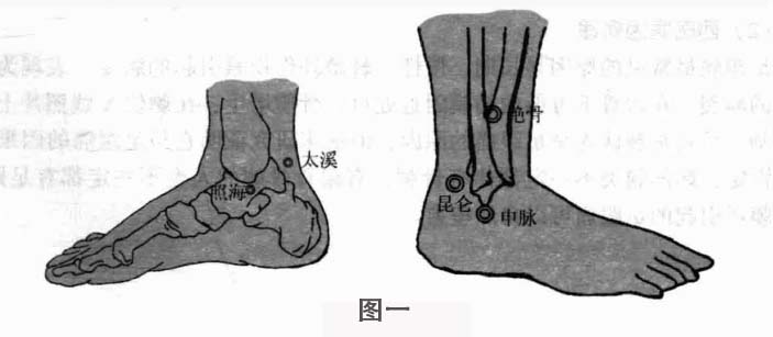 足跟痛钩针疗法