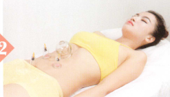 腹泻拔罐部位图解