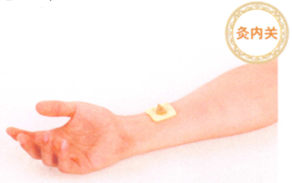 呃逆艾灸哪个部位图解