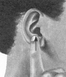 耳鸣-耳痛按摩部位图解