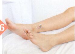 慢性盆腔炎拔罐部位图解