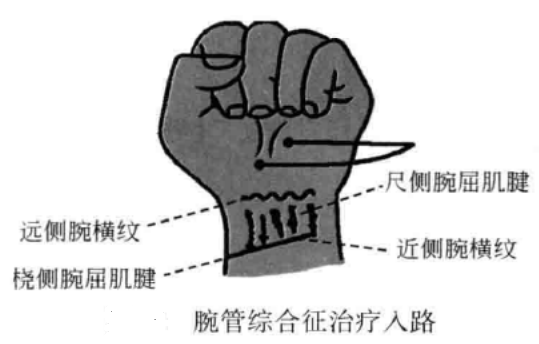 小针刀操作手术入路
