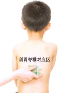 小儿腹泻刮痧部位图解
