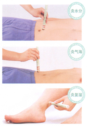 慢性肾炎艾灸哪个部位图解