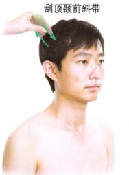 中风后遗症刮痧部位图解