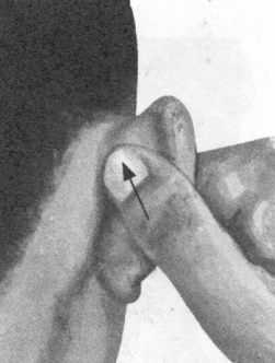 耳鸣-耳痛按摩部位图解