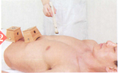 甲亢艾灸哪个部位图解