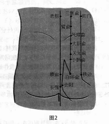 原发性痛经磁圆梅针疗法