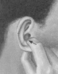 腰椎间盘突出症按摩部位图解