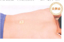 食欲不振艾灸哪个部位图解