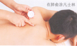 肺结核艾灸哪个部位图解