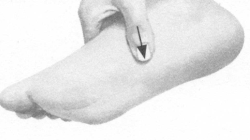 冠心病按摩部位图解