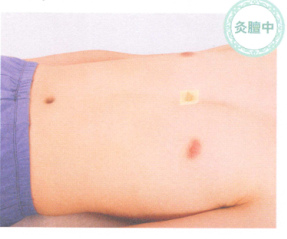 哮喘艾灸哪个部位图解