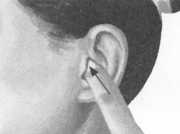 高脂血症按摩部位图解