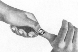 近视按摩部位图解