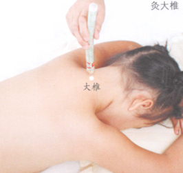 百日咳艾灸哪个部位图解