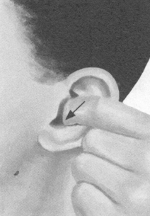 近视按摩部位图解