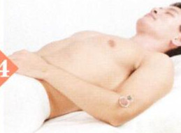 阴囊潮湿拔罐部位图解