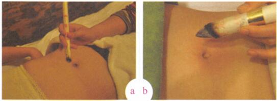 小儿胀气艾灸哪个部位图解