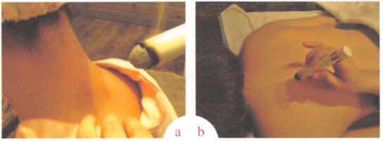 祛除雀斑艾灸哪个部位图解