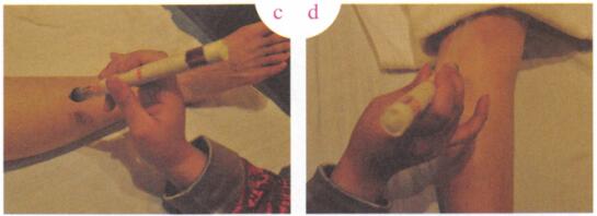 小儿遗尿艾灸哪个部位图解