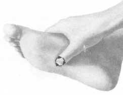 糖尿病按摩部位图解