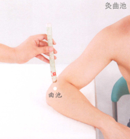 雀斑艾灸哪个部位图解