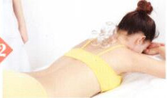 痤疮拔罐部位图解