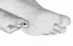 高脂血症按摩部位图解