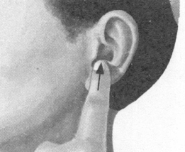 风湿病按摩部位图解