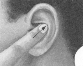 更年期综合征按摩部位图解