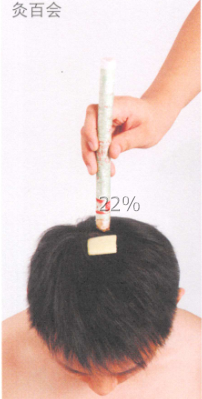 口腔溃疡艾灸哪个部位图解