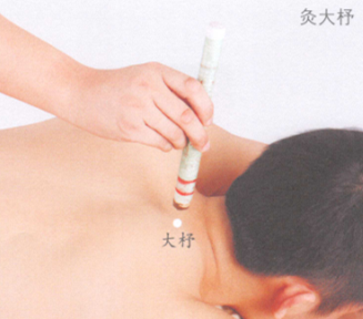 颈椎病艾灸哪个部位图解