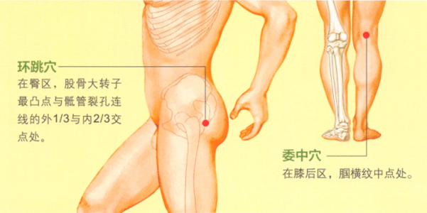 坐骨神经痛艾灸哪个部位图解