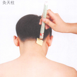 落枕艾灸哪个部位图解