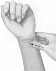 冠心病按摩部位图解